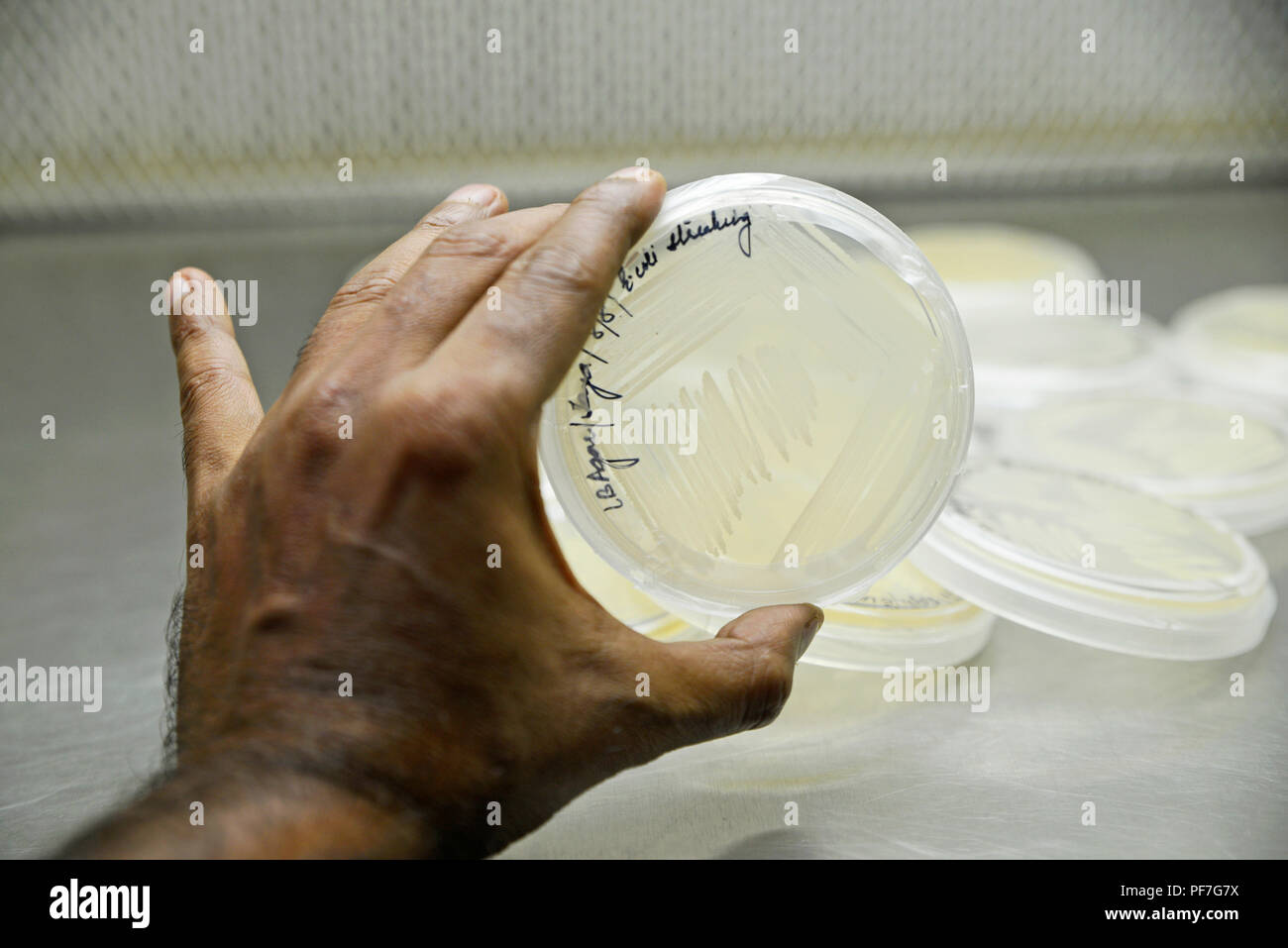 Bacteria culture plate Stock Photo Alamy