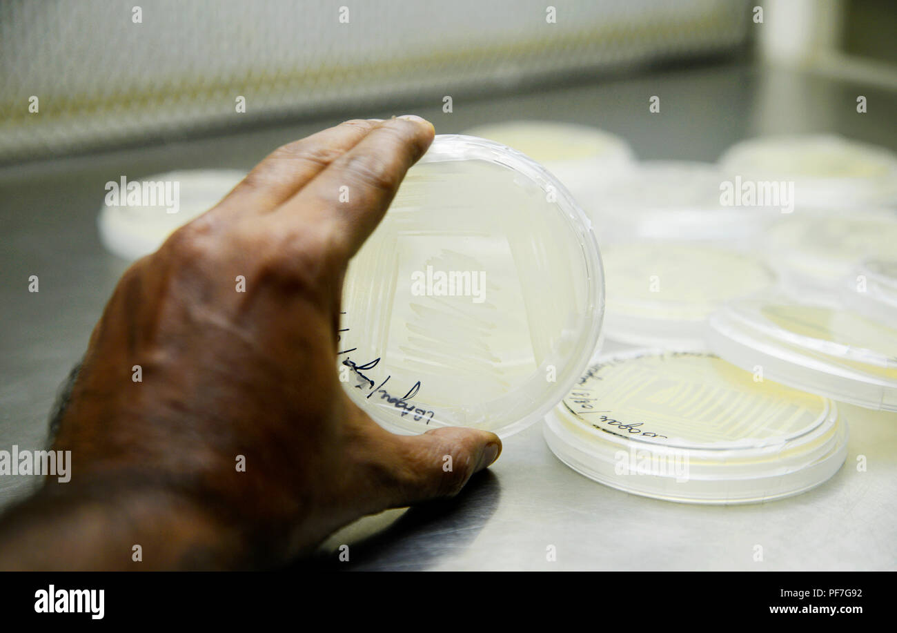 Bacteria culture plate Stock Photo Alamy