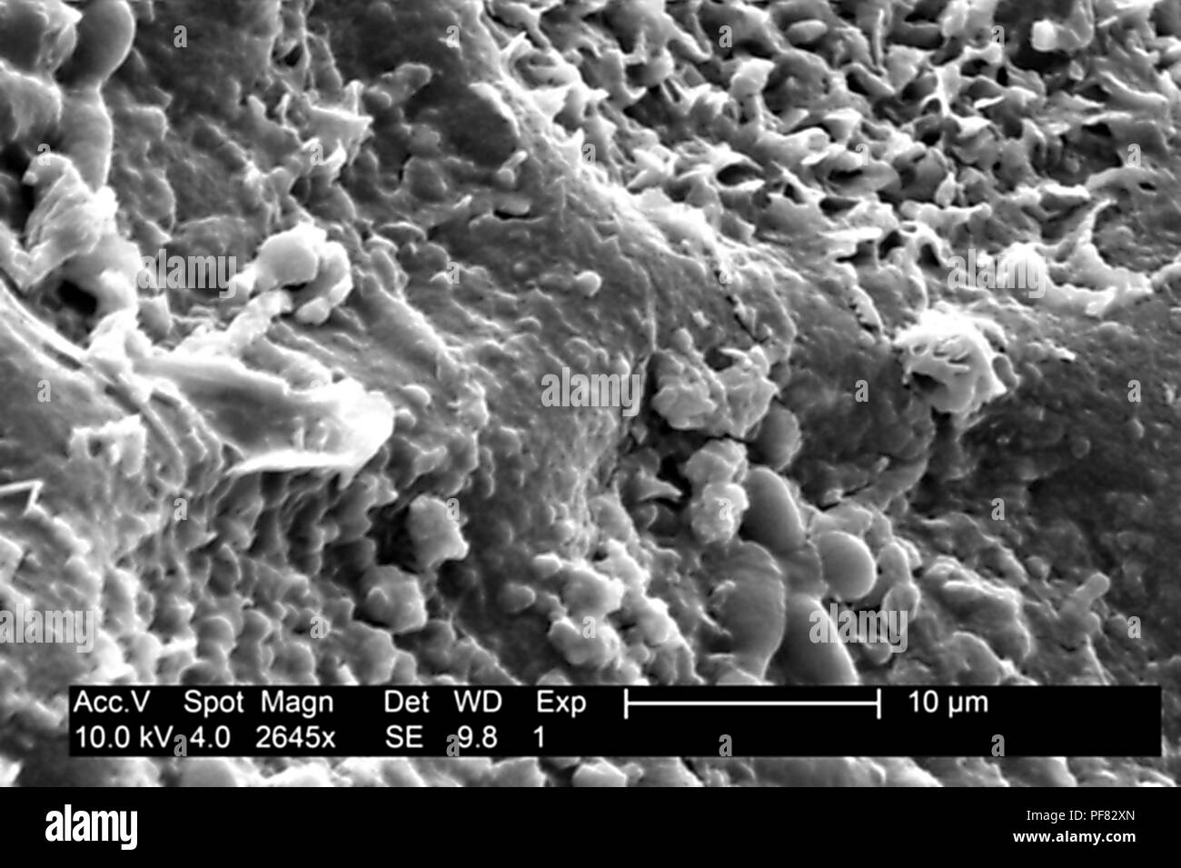 Textured surface details found on a honeydew melon (Cucumis melo), revealed in the 2645x magnified electron micrograph film, 2004. Image courtesy Centers for Disease Control (CDC). () Stock Photo