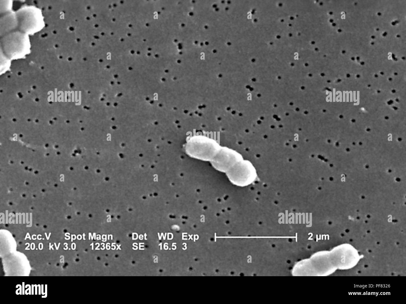 Gram-negative, non-motile Acinetobacter baumannii bacteria revealed in the 12365x magnified scanning electron microscopic (SEM) image, 2004. Image courtesy Centers for Disease Control (CDC) / Matthew J. Arduino, DrPH, Janice Carr, Jana Swenson. () Stock Photo
