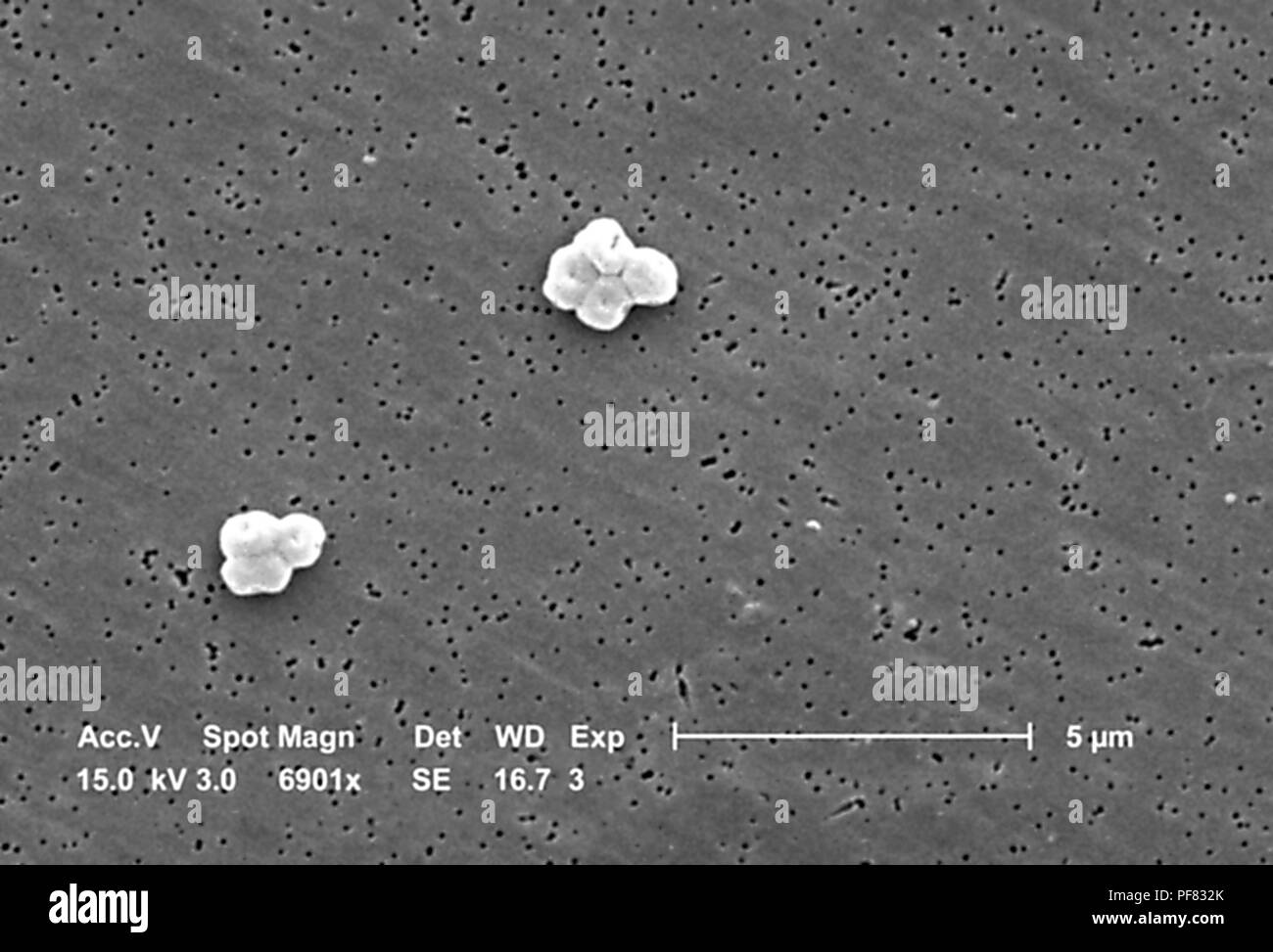 Gram-negative, non-motile Acinetobacter baumannii bacteria revealed in the 6901x magnified scanning electron microscopic (SEM) image, 2004. Image courtesy Centers for Disease Control (CDC) / Matthew J. Arduino, DrPH, Janice Carr, Jana Swenson. () Stock Photo