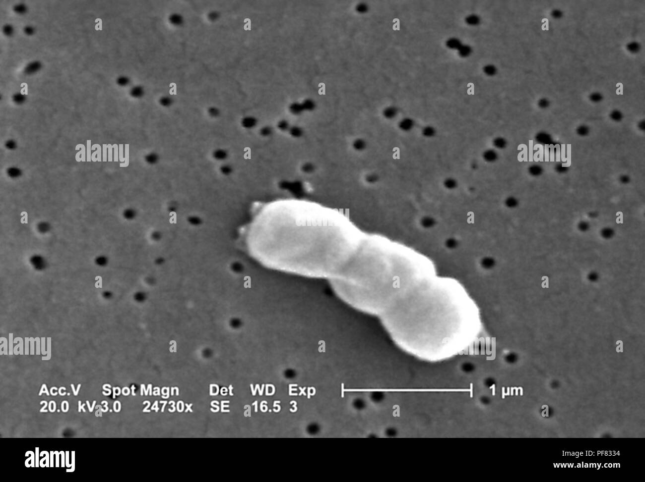 Gram-negative, non-motile Acinetobacter baumannii bacteria revealed in the 24730x magnified scanning electron microscopic (SEM) image, 2004. Image courtesy Centers for Disease Control (CDC) / Matthew J. Arduino, DrPH, Janice Carr, Jana Swenson. () Stock Photo