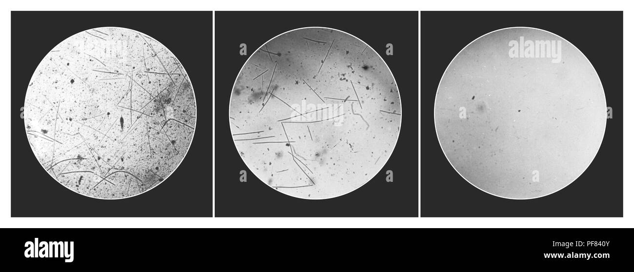Photomicrographic images hires stock photography and images Alamy
