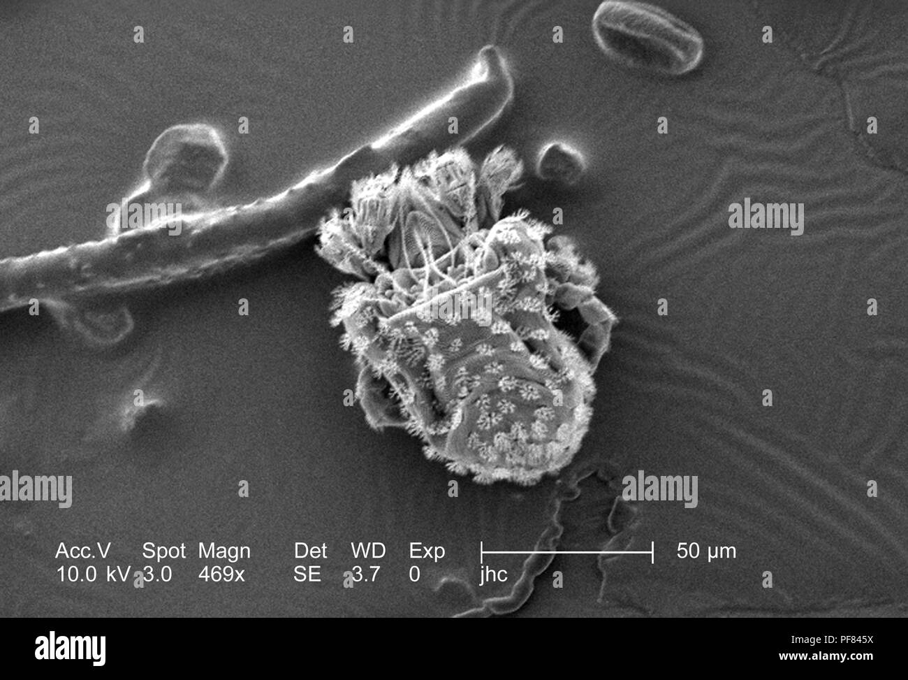 Presence of numbers fungivorous soil and leaf-litter/moss mites from the Family Nanorchestidae found on the lizard skin, revealed in the 469x magnified scanning electron microscopic (SEM) image, 2006. Image courtesy Centers for Disease Control (CDC) / William L. Nicholson, Ph.D. Cal Welbourn, Ph.D. Gary R. Mullen. () Stock Photo