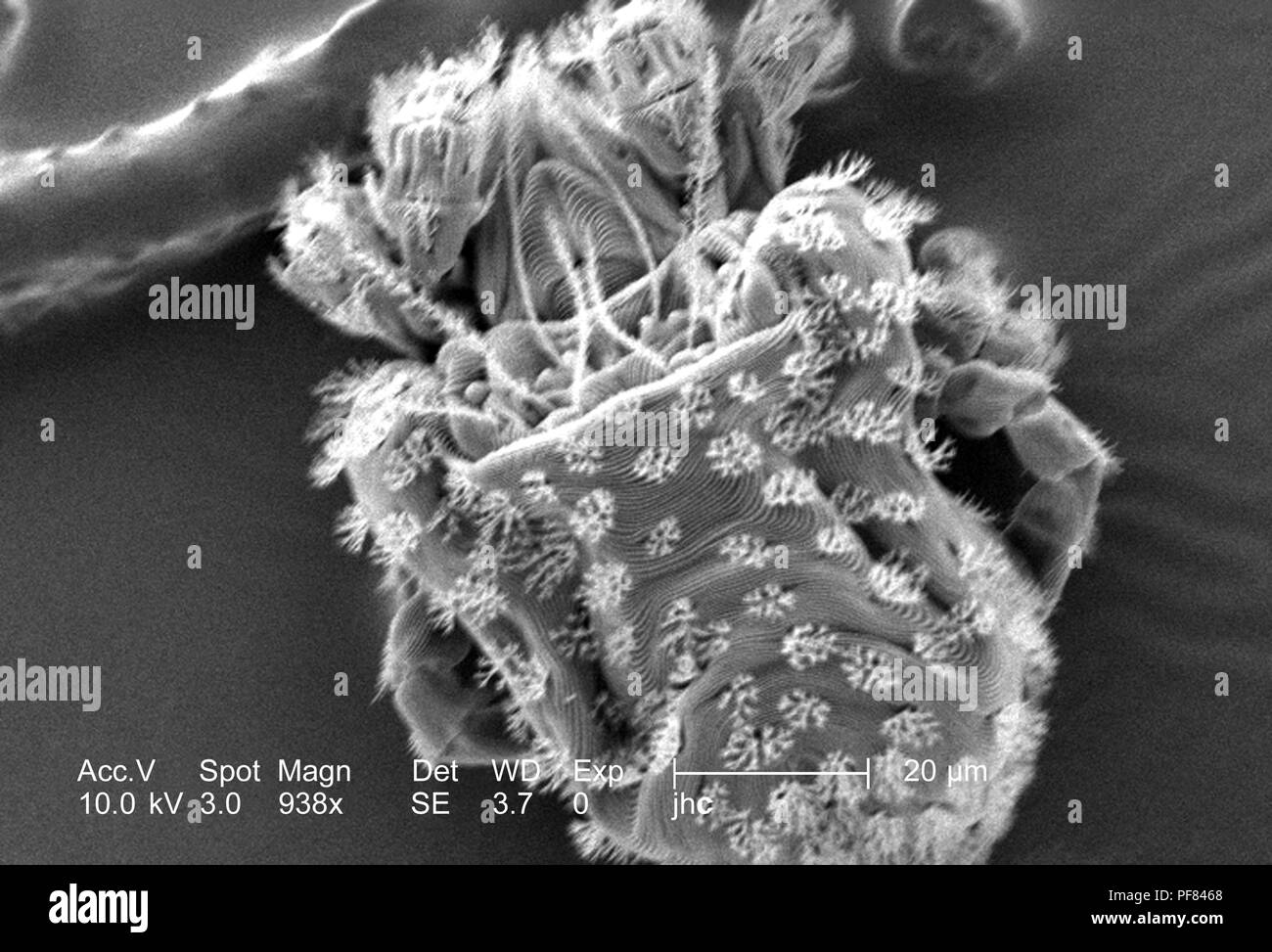 Presence of numbers fungivorous soil and leaf-litter/moss mites from the Family Nanorchestidae found on the lizard skin, revealed in the 938x magnified scanning electron microscopic (SEM) image, 2006. Image courtesy Centers for Disease Control (CDC) / William L. Nicholson, Ph.D. Cal Welbourn, Ph.D. Gary R. Mullen. () Stock Photo