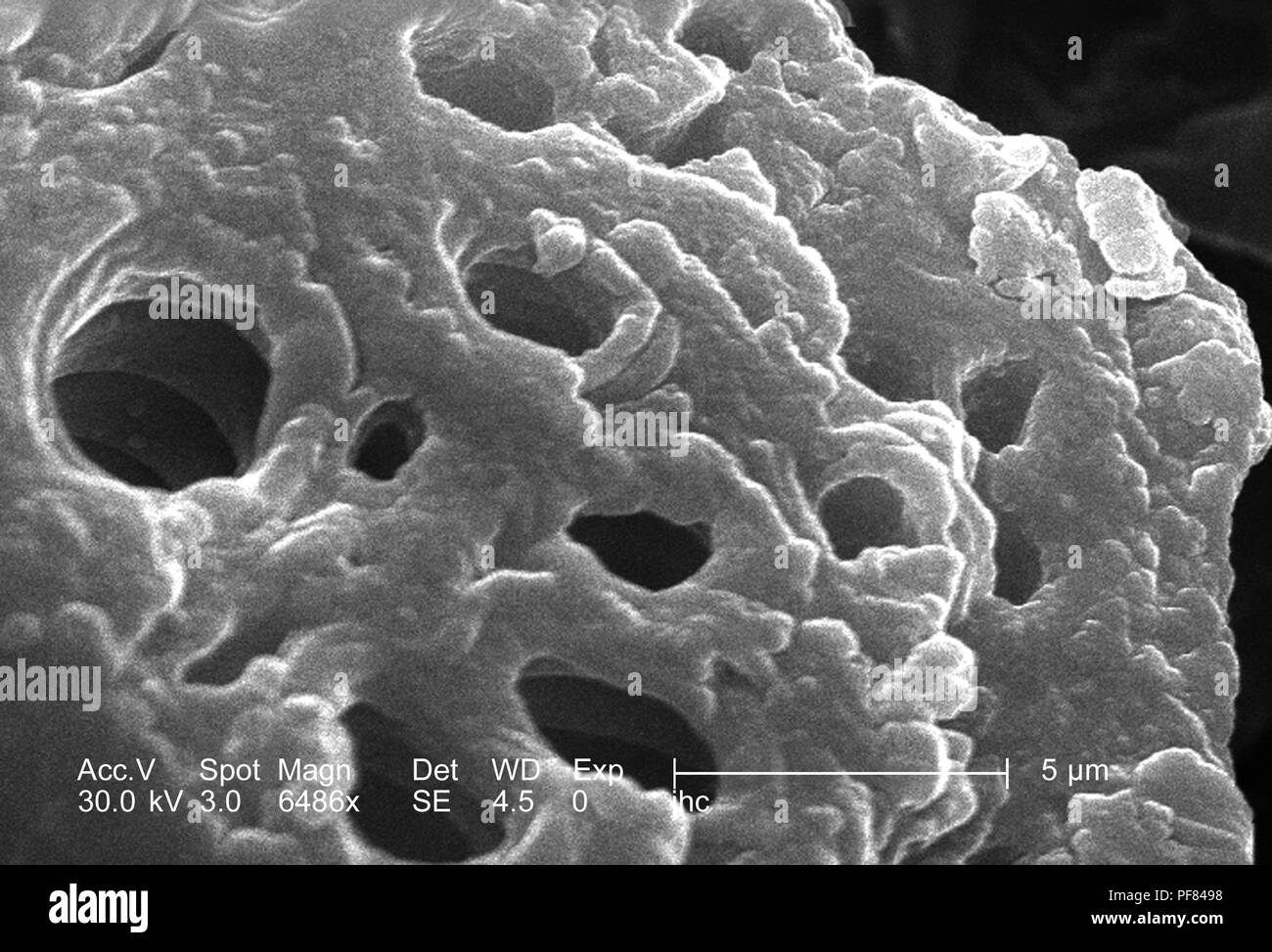 Morphologic surface characteristics of a 'dandelion clock' from a Common Dandelion (Taraxacum officinale plant), depicted in the 6486x magnified scanning electron microscopic (SEM) image, 2006. Image courtesy Centers for Disease Control (CDC) / Janice Haney Carr. () Stock Photo