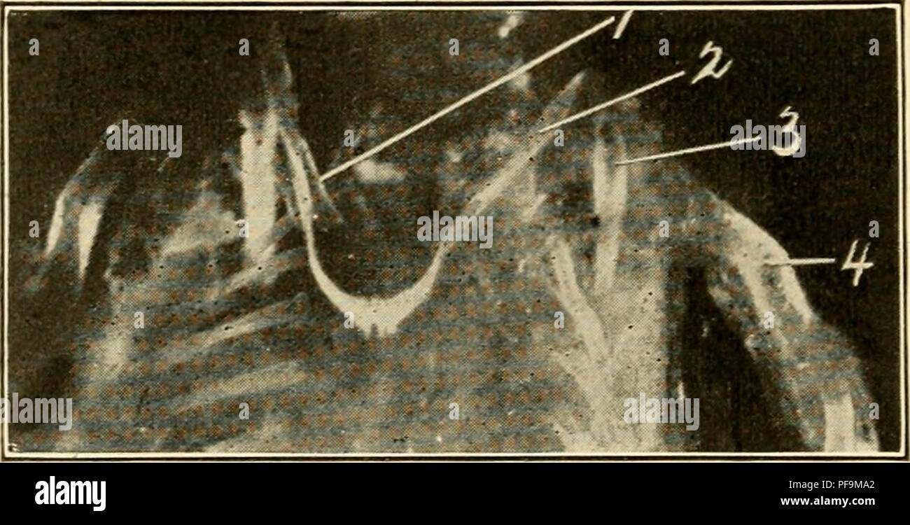 Pectoral girdle hi-res stock photography and images - Alamy