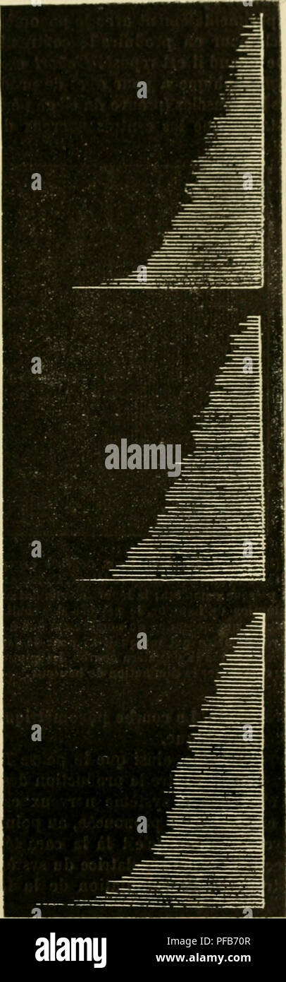 . Dictionnaire de physiologie. Physiology. FATIGUE. I7M e ? (li-;ons : |ircinier do^rÃ©, car tout porle Ã ,'croire (jue poiir des efforts excessifs il y a Ã©^a- lemi'iil laliRue des contres volontaires. Olle affirmalinn osf d'ailleurs basÃ©e sur les faits suivants : 1Â° Le ' accusu noltonuMit un li';4Â«Ã®r (Ic^r6 de di-pression cÃ©rÃ©brale aprÂ»''s le travail cr;Â»oi,'iapliique. Nous pouvons on inlV-ci-r iustom&quot;nt ipio pour des enorls plus intenses (jue le travail ergoj.'raplii(iuo les distinctions entre les ty[)os s'eiÃ¯ai-i'- raient, et que dans ces conditions la par- ticipation des cen Stock Photo