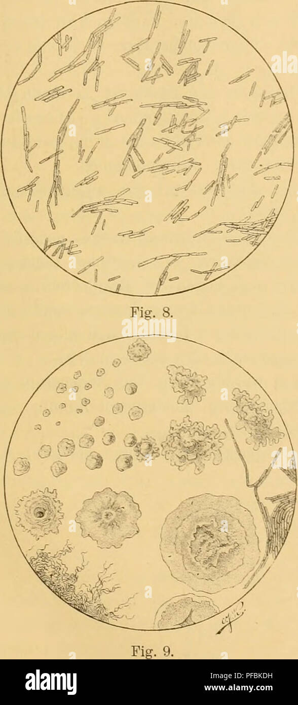 Diplococcus hi-res stock photography and images - Alamy