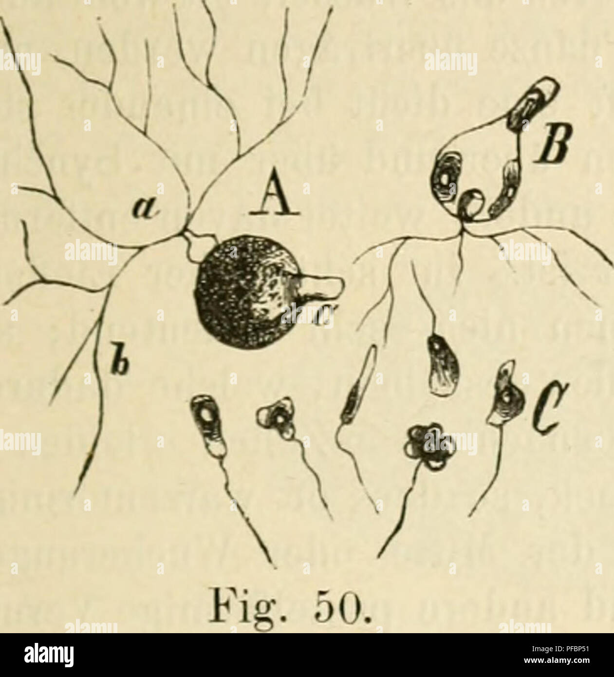 . Der gegenwrtige Standpunkt der Mycologie mit Rcksicht auf die Lehre von den Infections-Krankheiten. Pathogenic fungi. 133 wand durchbohrte. Im Innern der pjrÃ¶sseren Zelle entstehen nun die SchwÃ¤rmsporen; das ganze Gebilde kommt innerhalb der befallenen Pflanze zur Entwicklung, nur der Hals ragt heraus. Die austretenden und auch noch die in der Sporan- giurazelle befindlichen SchwÃ¤rmsporen, Fig. 50, B u. C zeigen die schon beschriebene araÃ¶ben- artige Bewegung; sie dehnen sich der LÃ¤nge nach und seitlich, schieben FortsÃ¤tze aus, ziehen dieselben wieder ein etc. Diese Bewegung findet sow Stock Photo