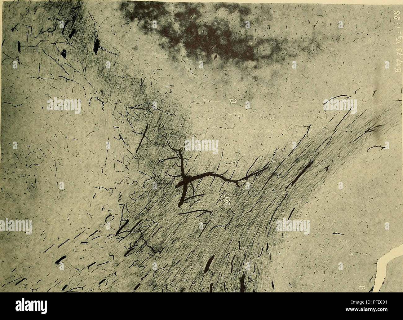 Nerve fibers brain hi-res stock photography and images - Alamy