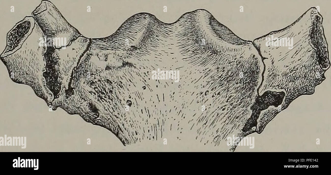 Brustbein High Resolution Stock Photography And Images Alamy