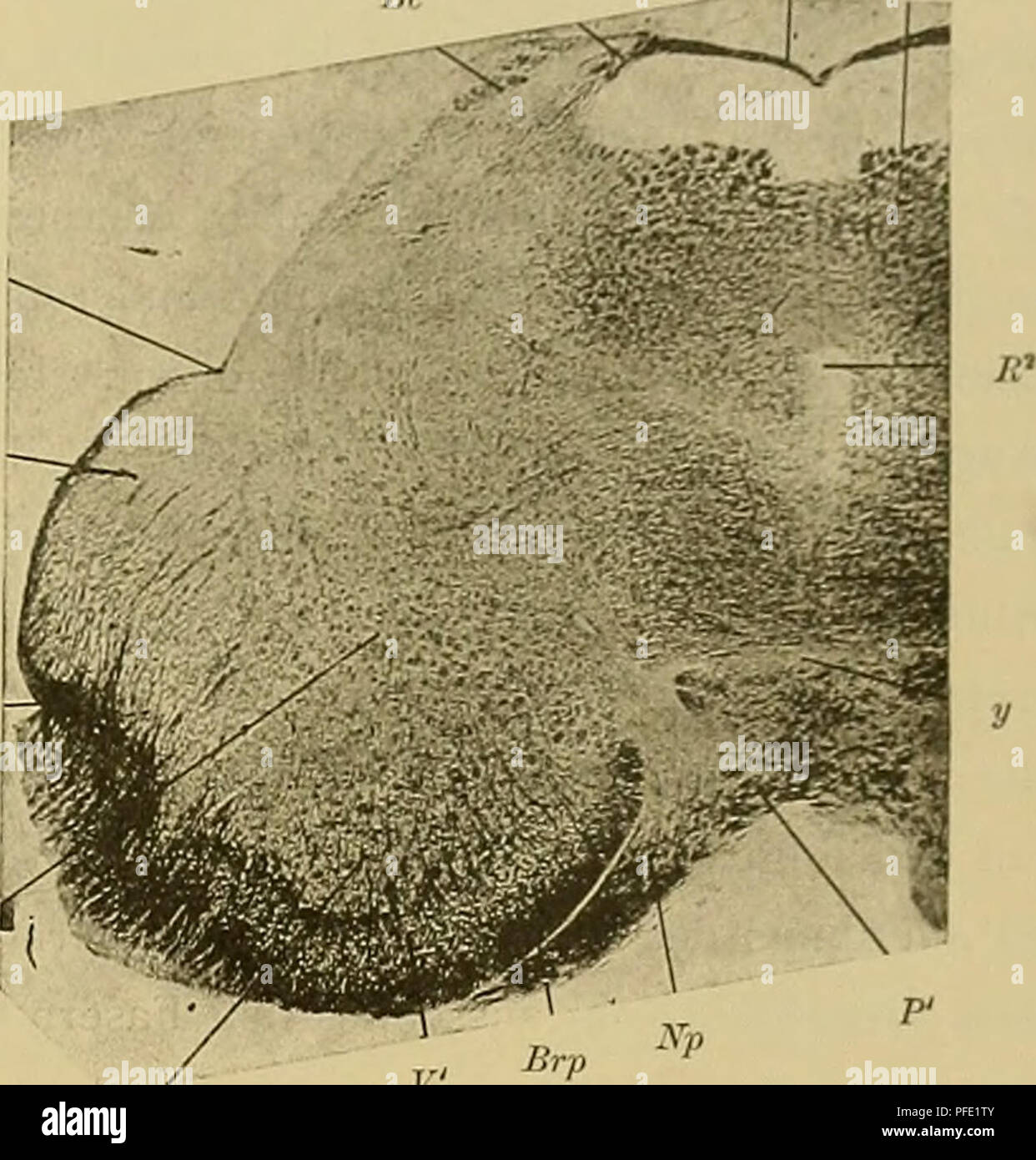 . Denkschriften der Medicinisch-Naturwissenschaftlichen Gesellschaft zu Jena. Flp 69 Das Centralnervensystem der Monotremen und Manupialier. gc7 Die Raphe (R) ist in ihrem basalen Theil schon wesentlich verbreitert und geht schliesslich in eine breite graue Masse über, welche den ganzen Zwischenraum zwischen der rechten und linken Eminentia trigemini ausfüllt. Man sieht hier auch bereits einige Faserkreuzungen. Die Verfolgung der Serie ergiebt, dass diese basale graue Masse mit den Faserkreuzungen bereits zur Ponsformation gehört. Das querovale Feld und die mediale Schleife schliessen sich dor Stock Photo