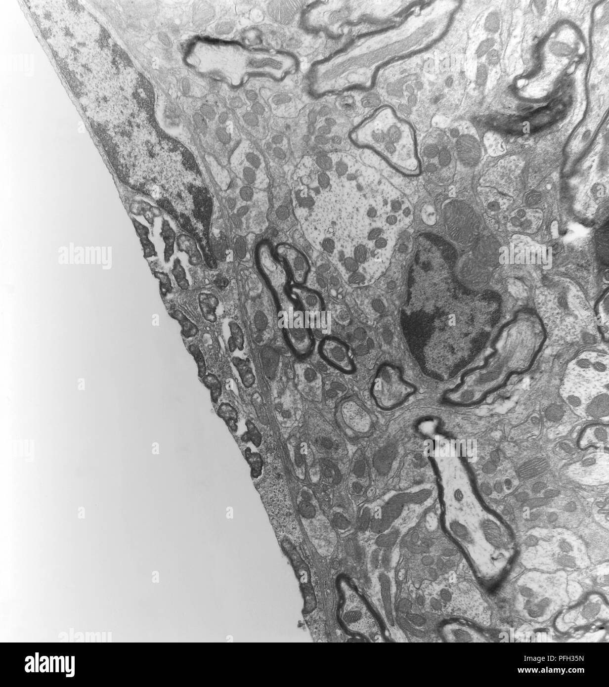 Tem Brain Brain capillary of a mouse experimentally infected intravenously with ...