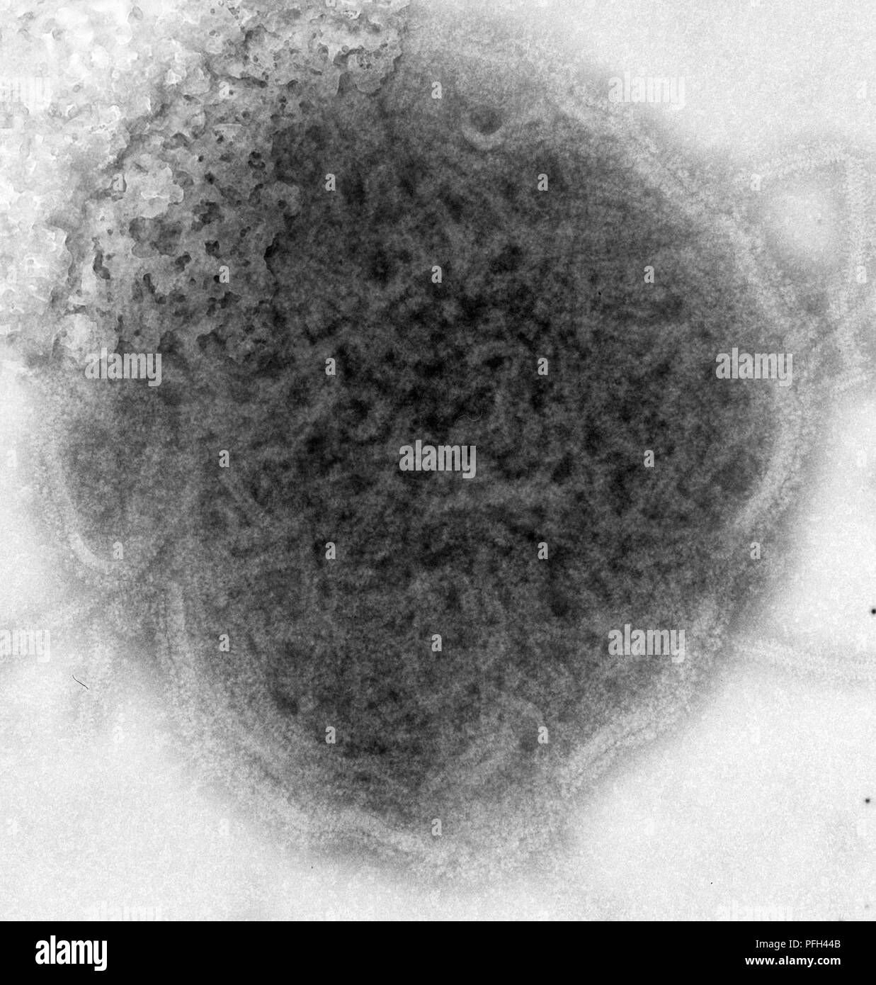 Ultrastructural features displayed by the mumps virus revealed in the