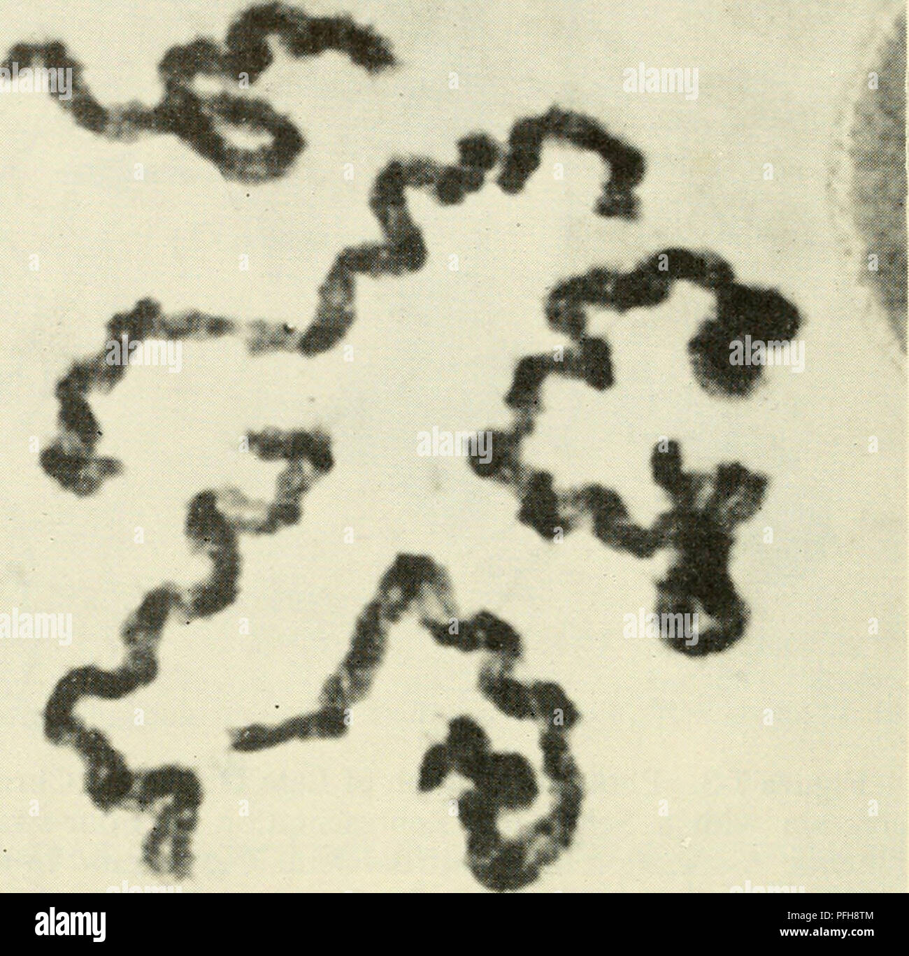 Figure 2 from Single-nucleotide polymorphism array-based characterization  of ring chromosome 18. | Semantic Scholar