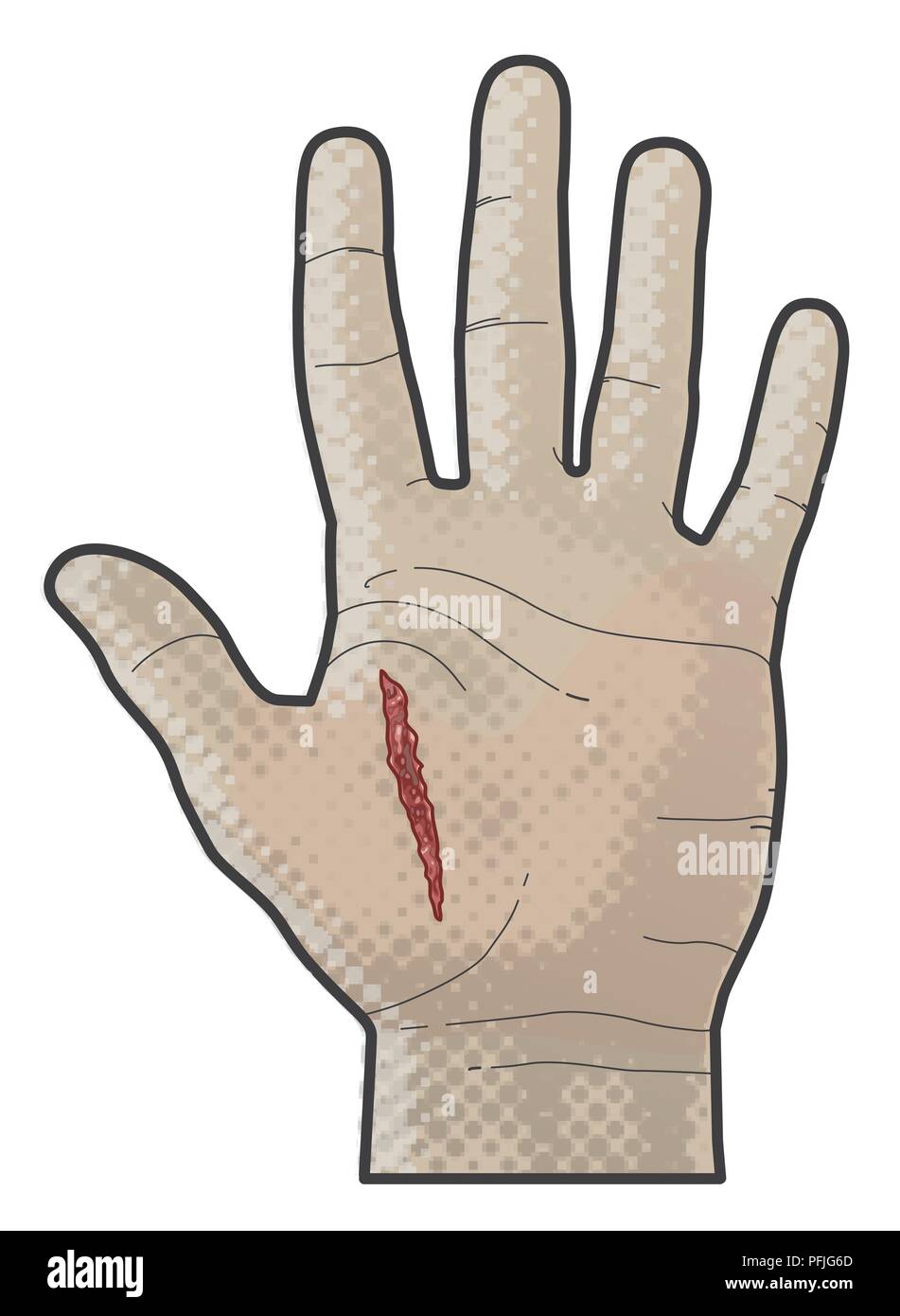 Incised wound hires stock photography and images Alamy