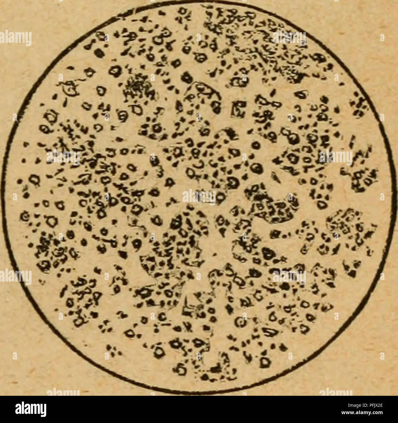 . The dairyman's manual; a practical treatise on the dairy. Dairying. tion of the butter globules into masses by throwing them violently together. There is now no caseous follicle to be rubbed off by pressure of the dasher and squeezing the globules between a close-fitting dash and the sides of the churn. No weary woman need now keep on an exhaustive effort to effect this wearing away a tough envelope, hour after hour, w4th the laborious up and down churn (most injurious to the vital organs of a female), because the follicle has no longer any existence, even in the imagination of the dairy exp Stock Photo