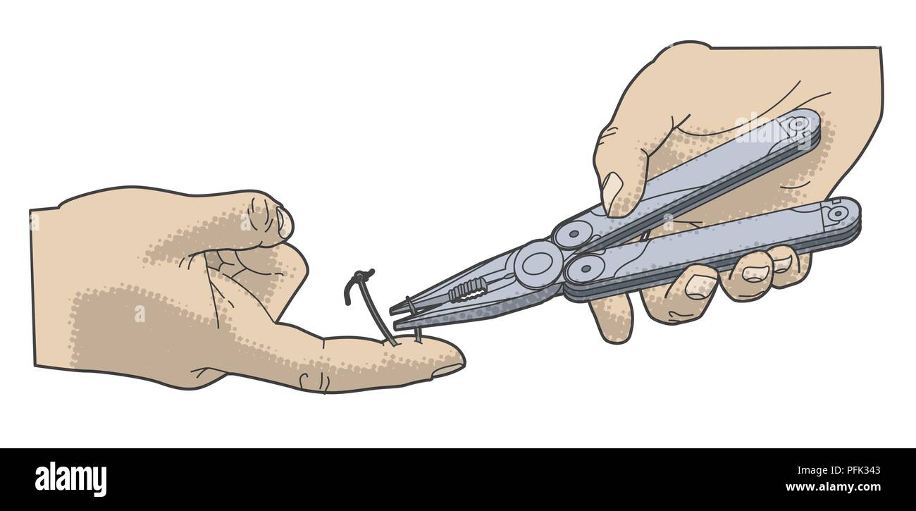 Digital illustration of cutting off barbed end of fish hook embedded in  finger using pair of pliers Stock Photo - Alamy