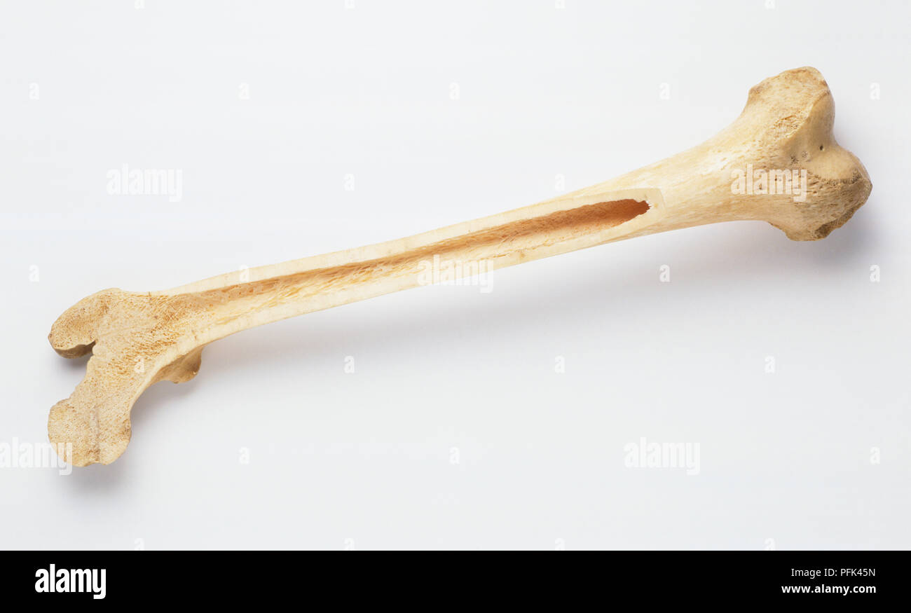 Section through left femur (human thigh bone) Stock Photo
