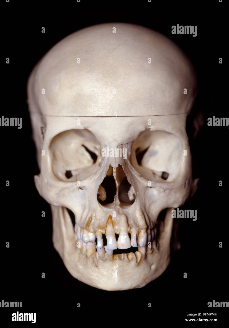 Female skull, front view Stock Photo