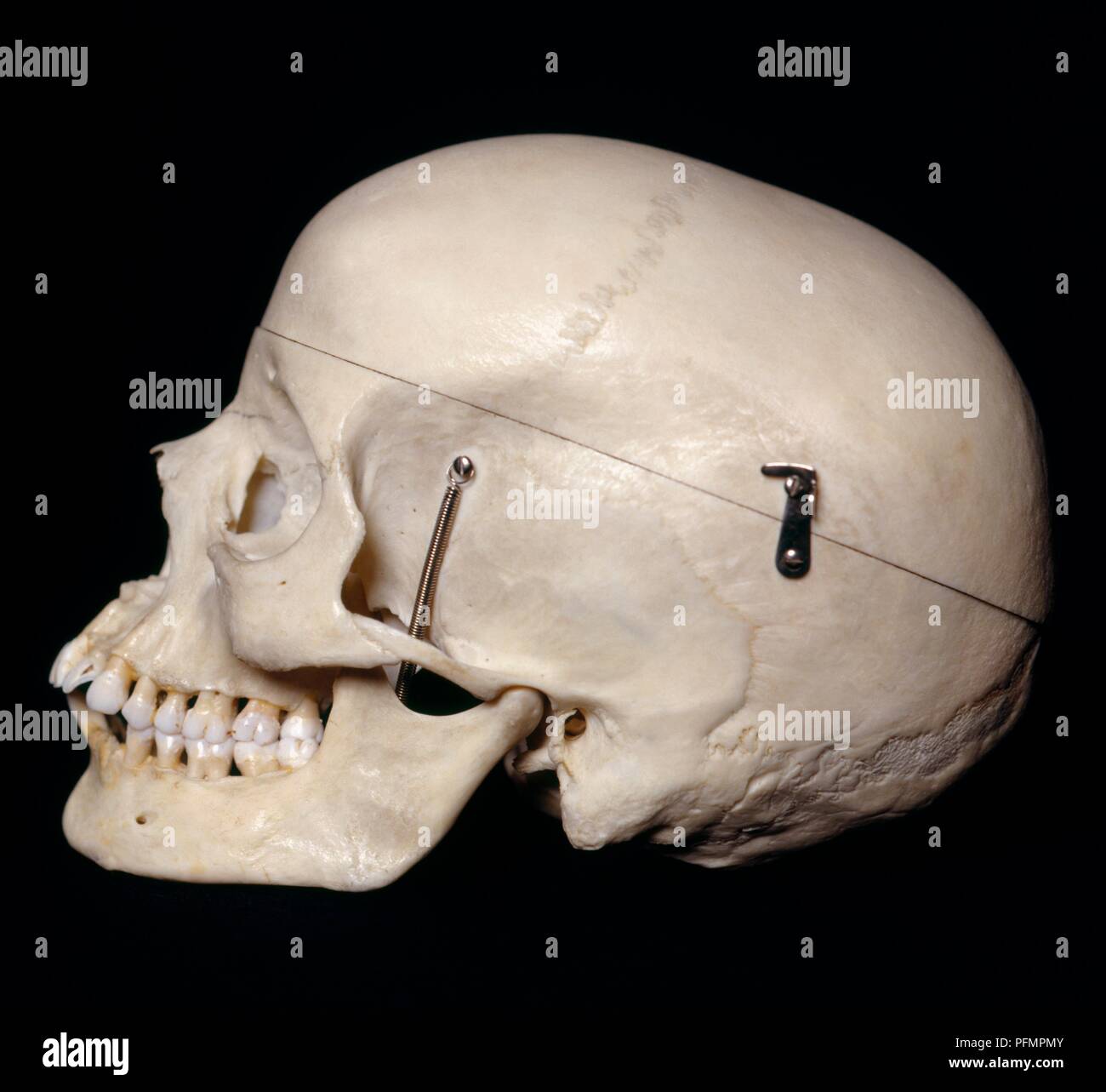 Female skull, side view Stock Photo