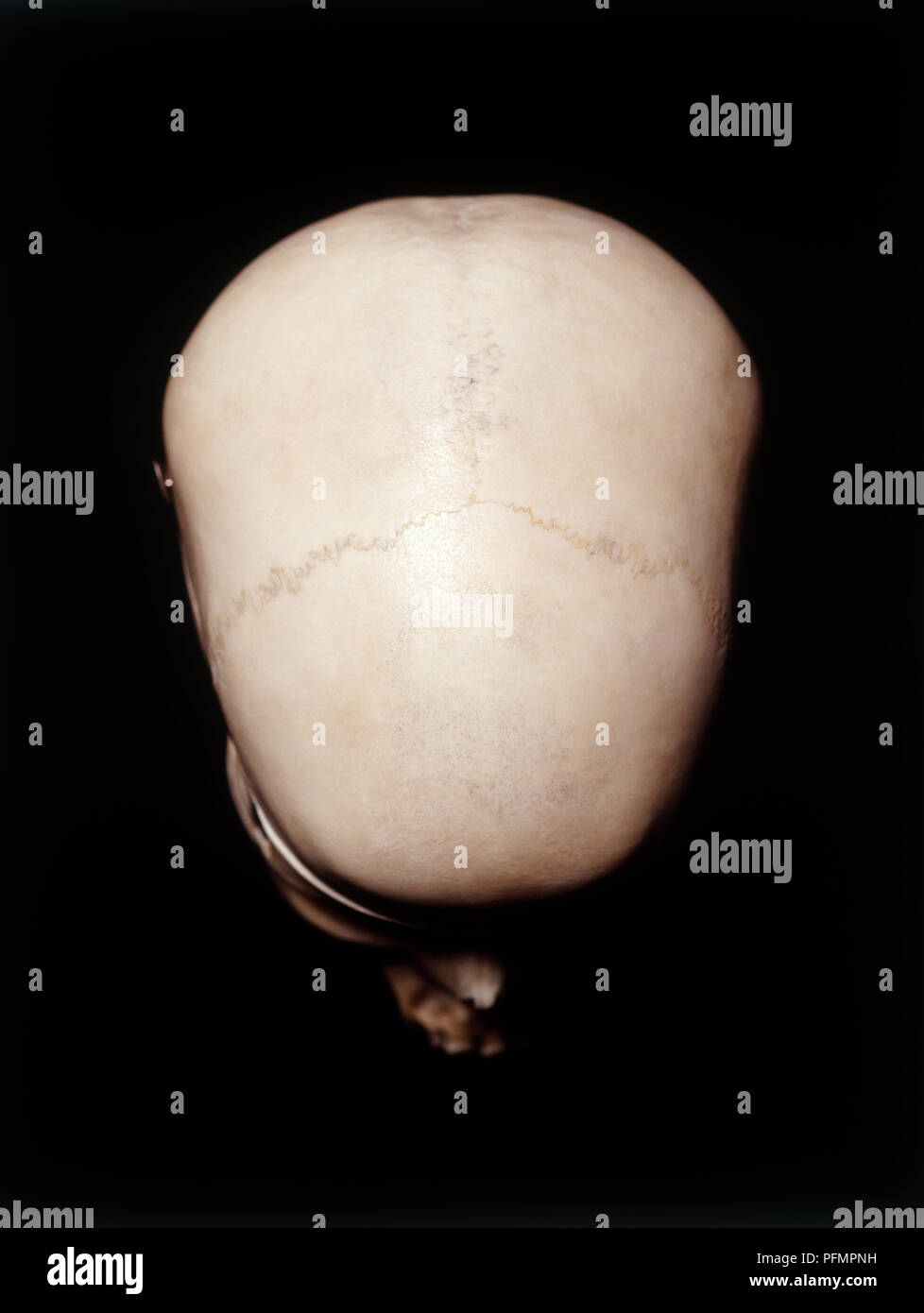 Female human skull, showing coronal suture and frontal bone, high angle view Stock Photo