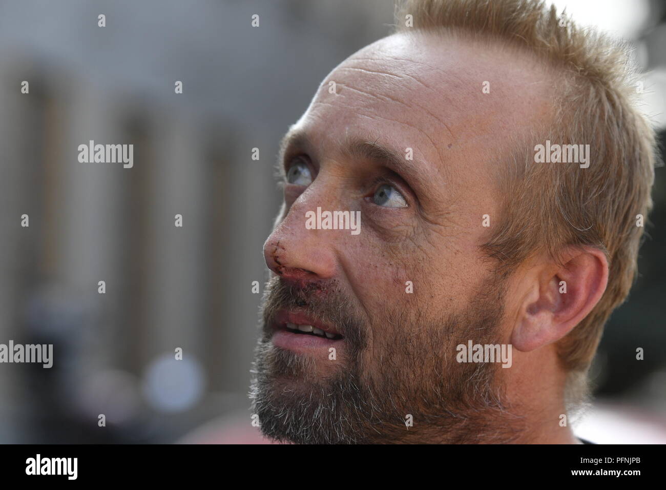 Czech lorry driver Martin Kucera, who survived the motorway bridge collapse in Genoa, Italy, last week, suffering three broken ribs, wants to return to his profession as soon as he recovers, he told reporters after his release from Prague's Thomayer hospital today, on Wednesday, August 22, 2018. He said at the press conference that he had survived the tragic accident thanks to a number of lucky coincidences. His lorry plunged 45 metres to the ground from the bustling Morandi motorway bridge after its part collapsed in north Italy last Tuesday. A total of 43 people died in the accident. (CTK Ph Stock Photo