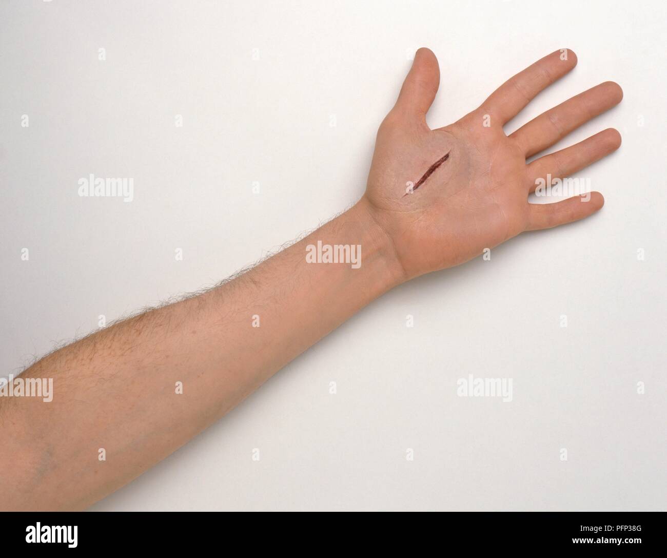 Deep cut on palm of hand Stock Photo Alamy Deep cut on palm of hand Stock Photo Alamy