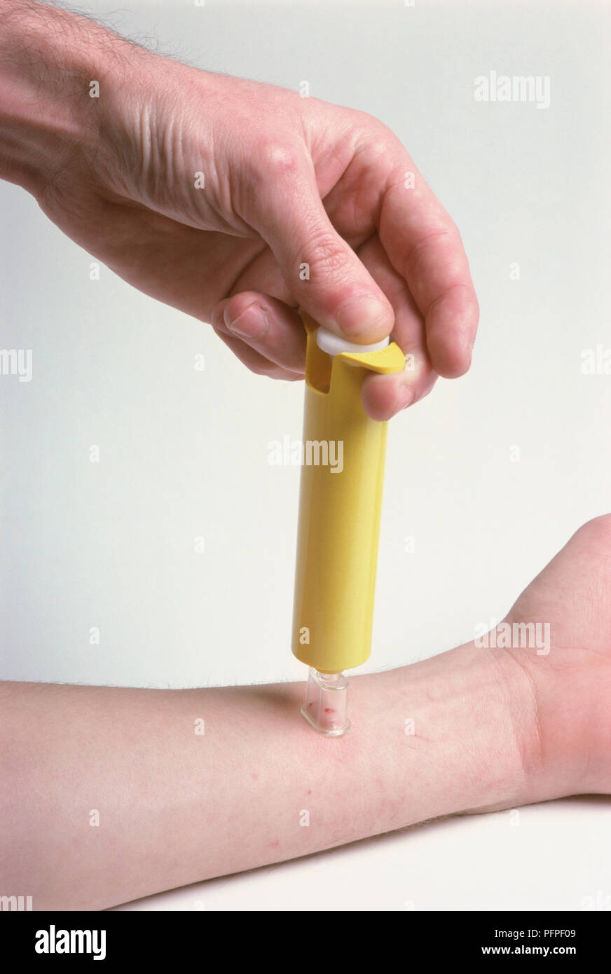 Man placing suction device or extractor pump onto snake bite on a woman's arm, close-up Stock Photo