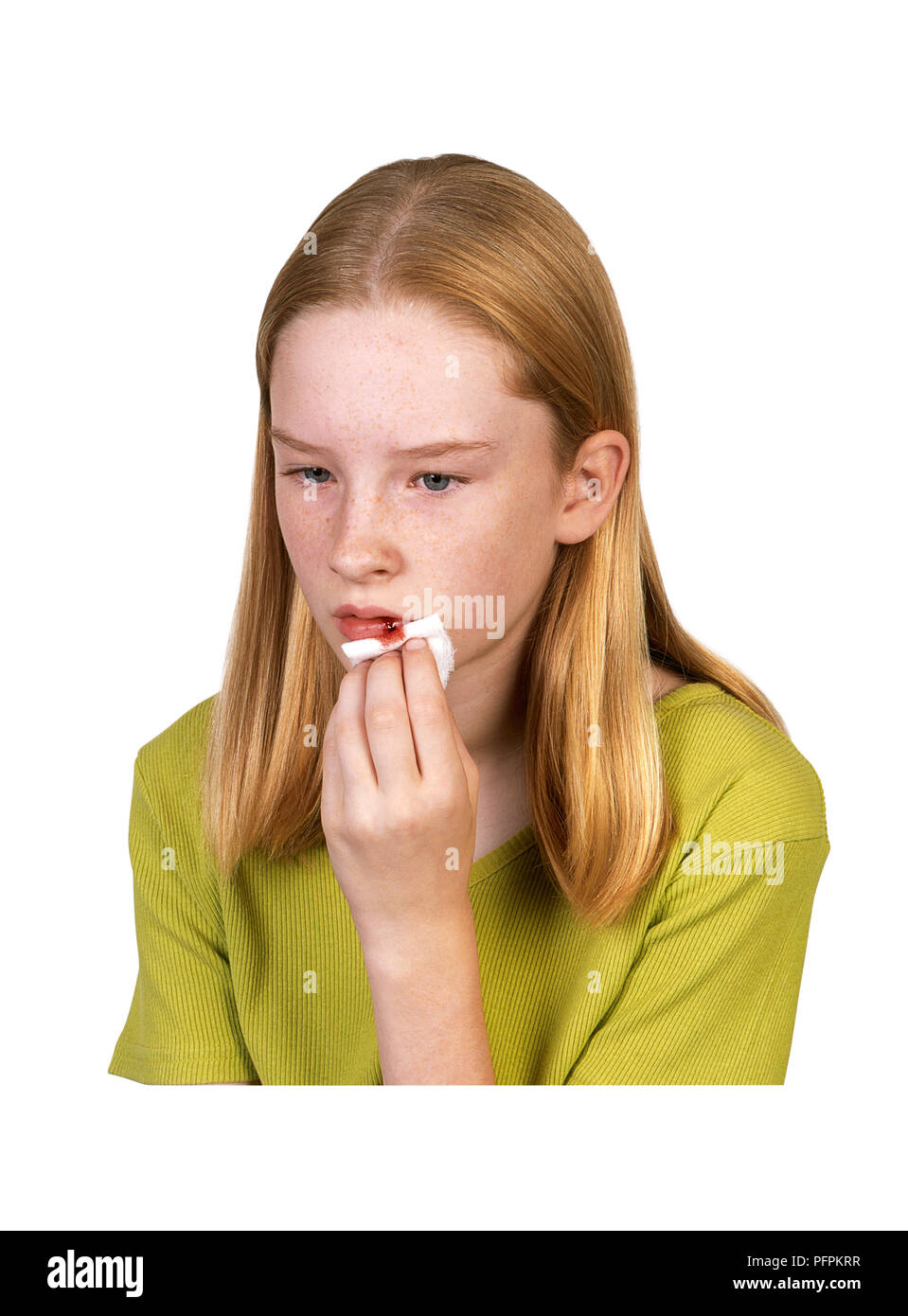 Girl holding tissue on bleeding lips Stock Photo