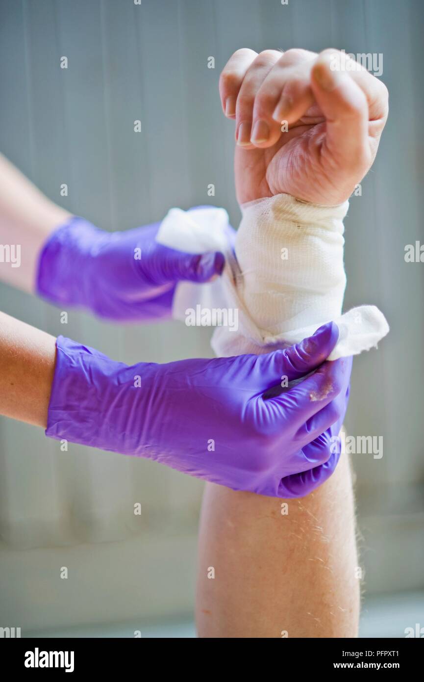 Patient being bandaged for wrist injury, close-up Stock Photo