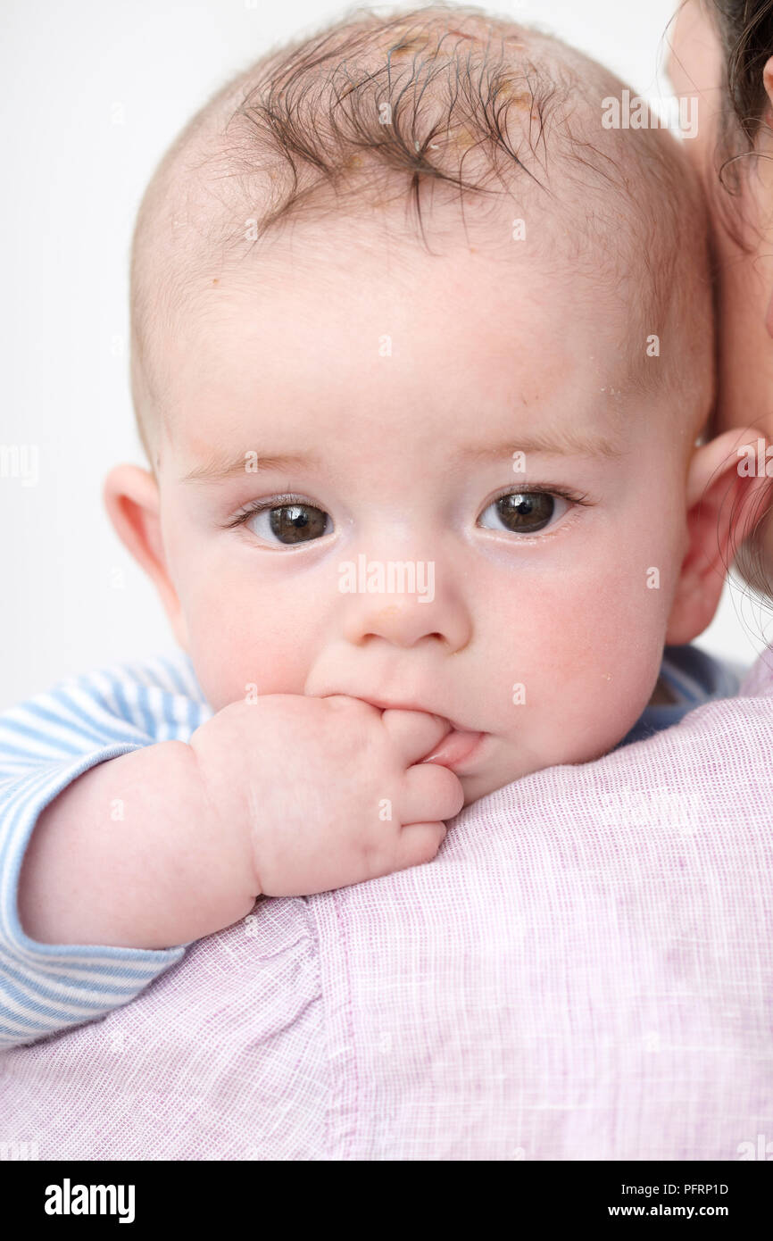Close Up Of Woman S Mouth Sucking In Cheeks Blurred Stock Photo Alamy