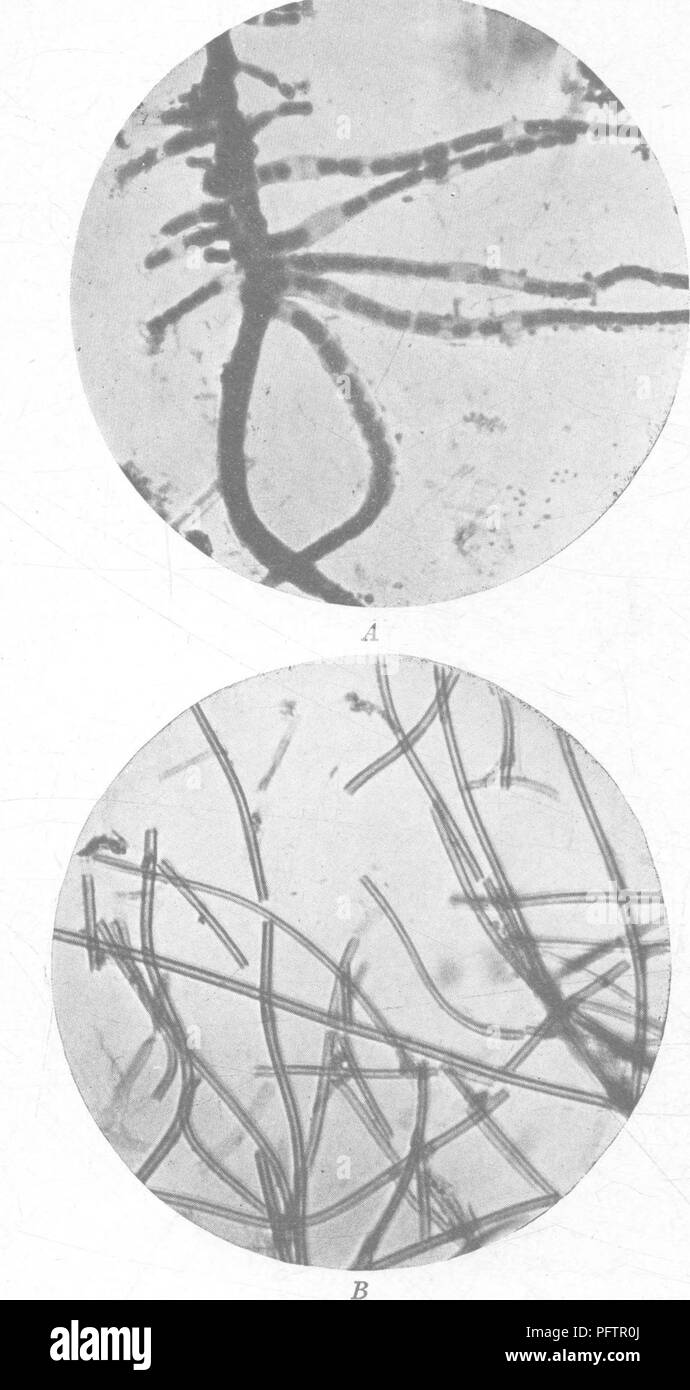 . A laboratory manual of soil bacteriology. Soil microbiology. Fig. 8.—Iron bacteria: A, Crenothrix thread showing germination of spores within sheath; X 850. B, Chlamydothrix showing simple and curved threads; X 850. 85. Please note that these images are extracted from scanned page images that may have been digitally enhanced for readability - coloration and appearance of these illustrations may not perfectly resemble the original work.. Fred, Edwin Broun, 1887-1981. Philadelphia, London, W. B. Saunders Company Stock Photo