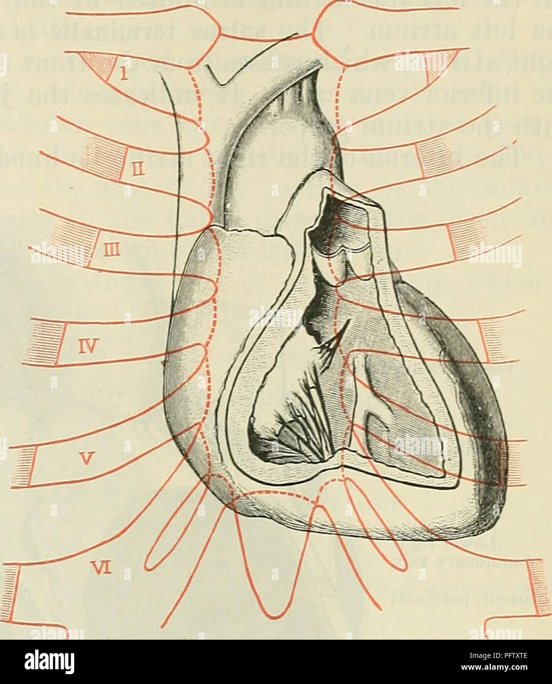 . Cunningham's Text-book of anatomy. Anatomy. THE CHAMBEES OF THE HEAET. 873 coronary sulcus, which runs obliquely from above downwards, and from left to right, from the level of the third left to that of the sixth right costal cartilage. The upper section of the surface, which is concave anteriorly, is formed by the atria; it is separated from the sternum by the ascending aorta and the pulmonary artery, and is continuous laterally with the auricles of the atria which, projecting forwards, embrace the great vessels. The lower section of the sterno-costal surface is convex; it is formed by the  Stock Photo
