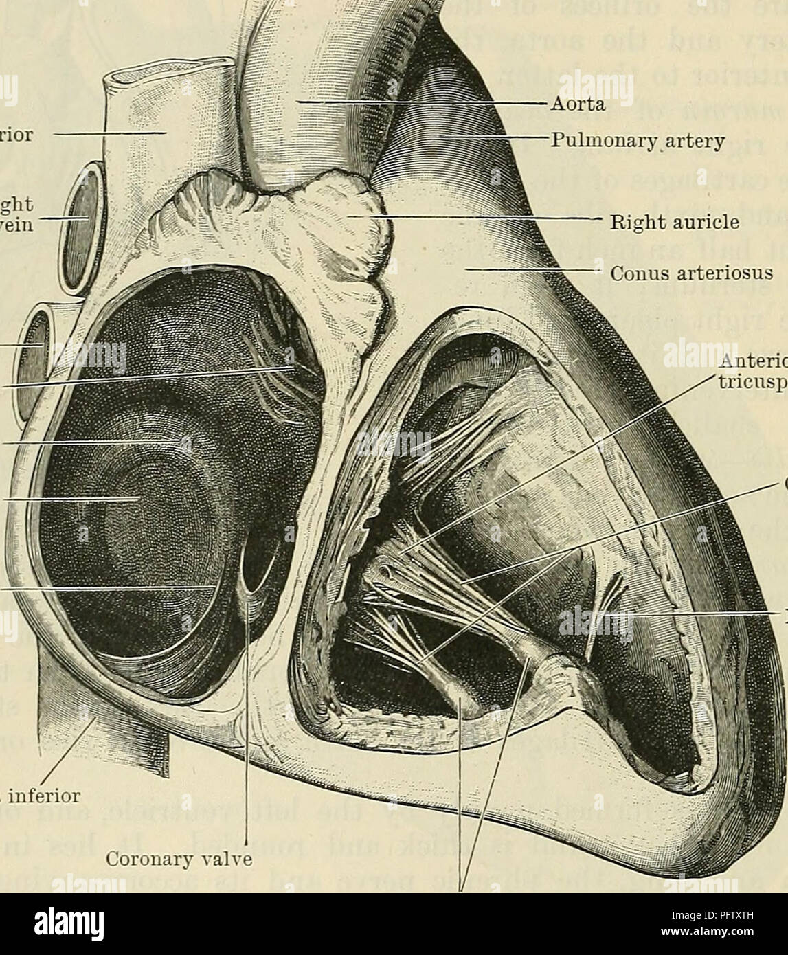 terminal sulcus heart