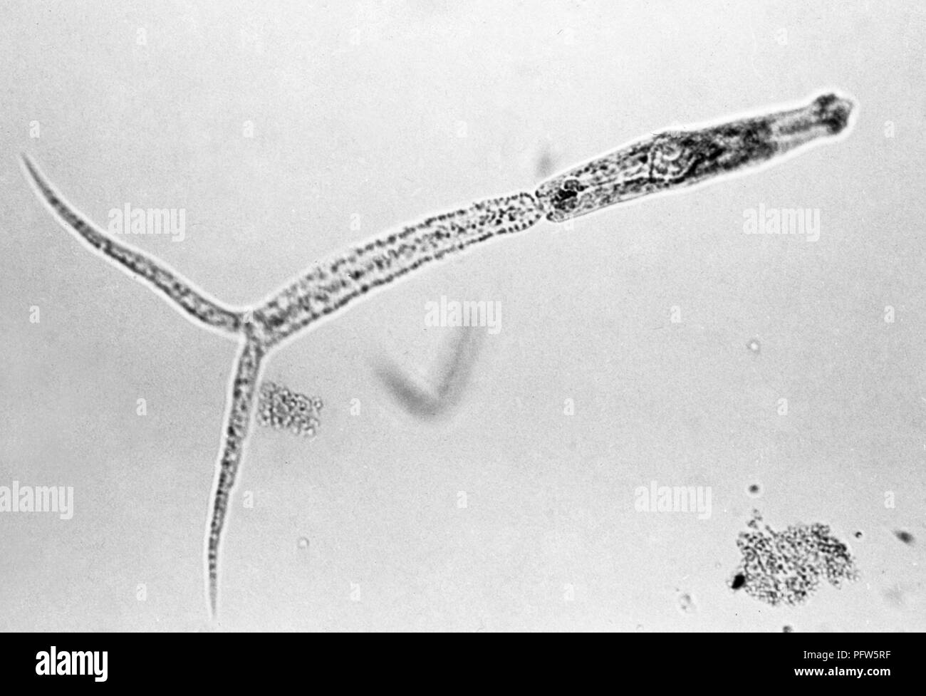 Morphologic details of a larval stage of a schistosomal cercaria revealed in the 150x magnified photomicrograph image, 1942. Image courtesy Centers for Disease Control (CDC) / Minnesota Department of Health, R.N. Barr Library, Librarians Melissa Rethlefsen and Marie Jones, Prof. William A. Riley. () Stock Photo