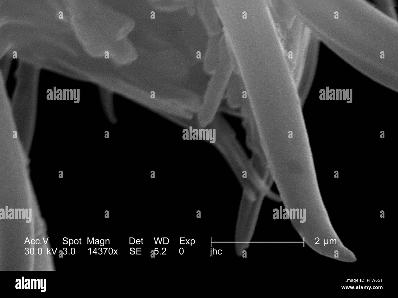 Morphologic features displayed on the distal tip of an Anopheles gambiae mosquito's 'labellum', revealed in the 14370x magnified scanning electron microscopic (SEM) image, 2006. Image courtesy Centers for Disease Control (CDC) / Paul Howell. () Stock Photo