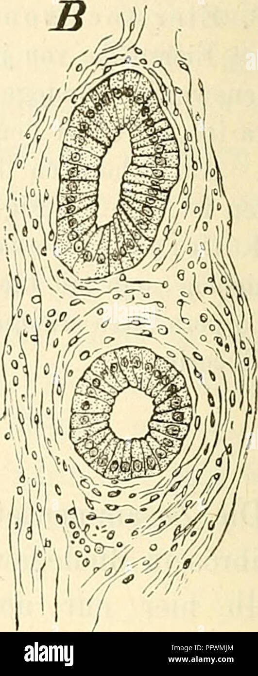 . Cursus der normalen Histologie zur EinfÃ¼hring in den Gebrauch des Mikroskopes, sowie in das practische Studium der Gewebelehre. Histology; Microscopy. Fig. 88. Uterus vom Menschen; HÃ¤matoxyliiifarbuiig, Balsam. A. Querschnitt durch die ganze Dicke der Schleimhaut. S. Schleimhaut, d. DrÃ¼sen, g. BlutgefÃ¤sse, M. Muskulatur. â ''-',. B. Durchschnitt durch 2 DrÃ¼sen, in A. mit d'. be/.eichnet. -&quot;&quot;/i. Die Schleimhaut sitzt, wenigstens am KÃ¶rper des Uterus, un- mittelbar auf der Muskulatur auf, von der aus kleine MuskelbÃ¼ndel nach dem Fundus der DrÃ¼sen hin in die Schleimhaut einstr Stock Photo