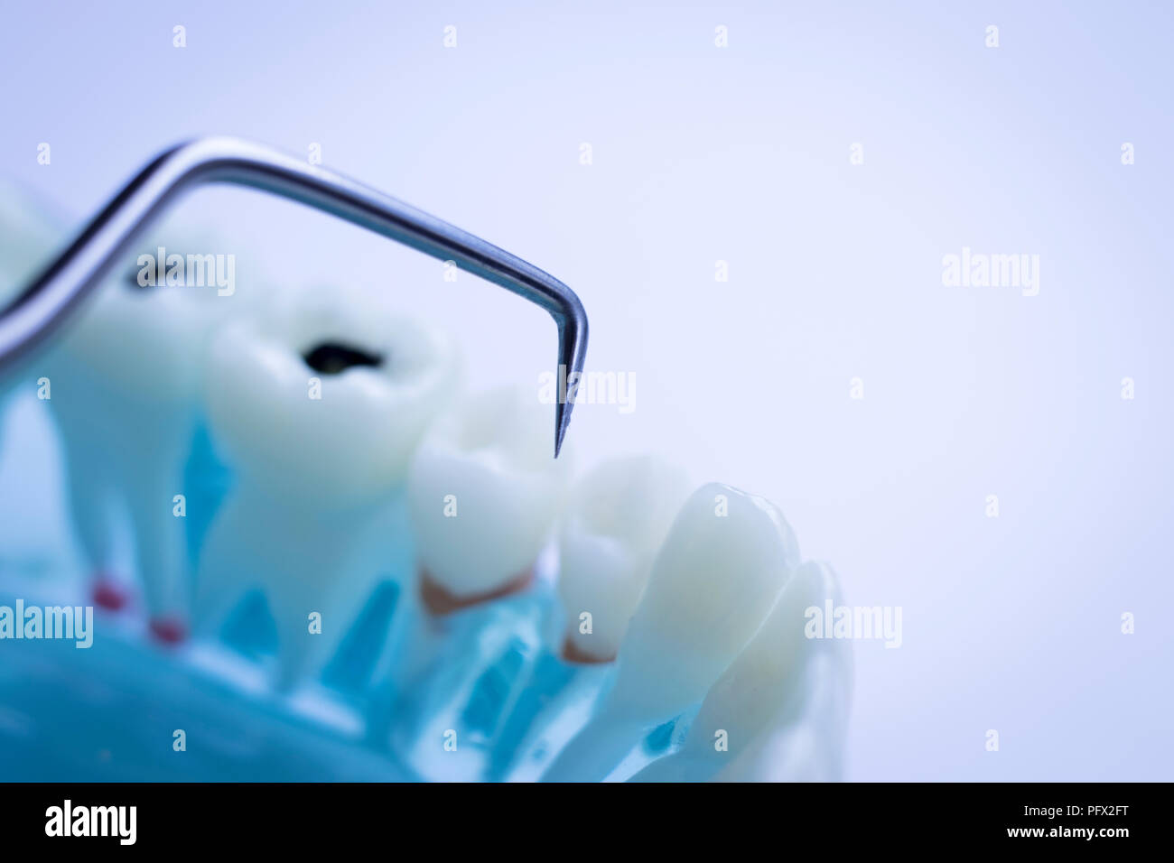 Dentist cleaning teeth with titanium metal tooth pick instrument to