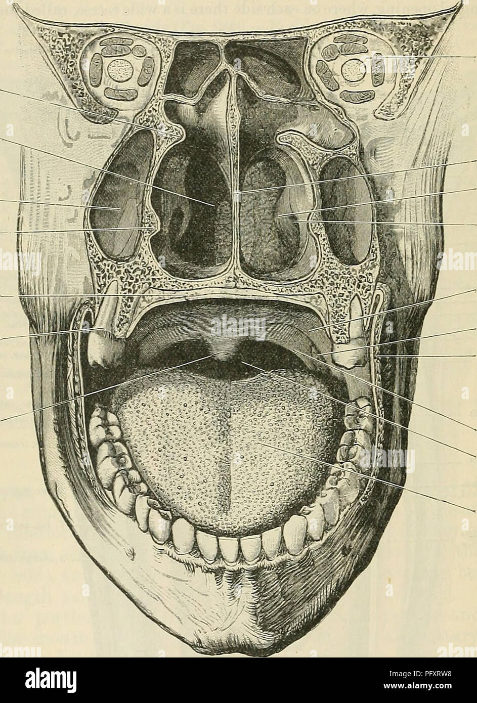 File:Antero-posterior section shape of cavities with and without
