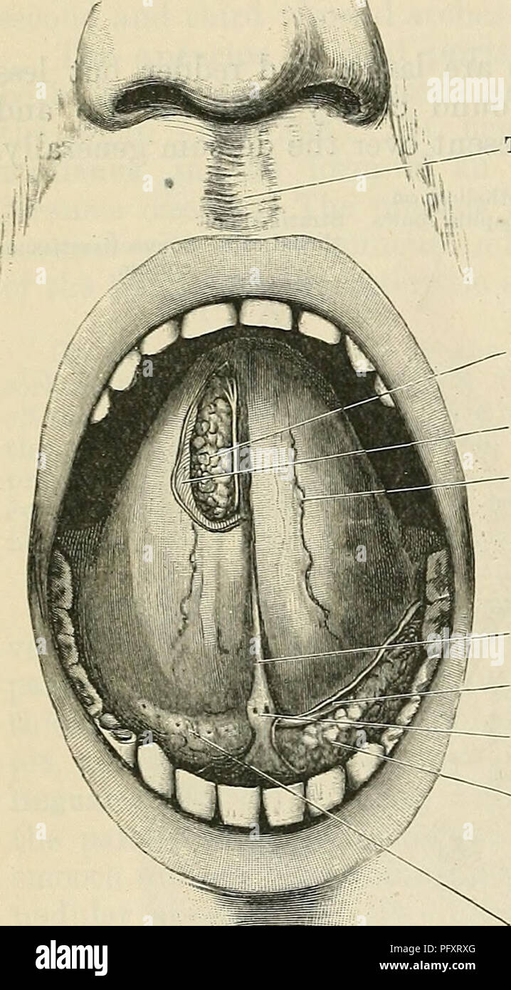 Ventral Tongue Anatomy