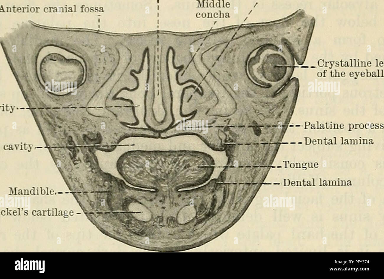 . Cunningham's Text-book of anatomy. Anatomy. 1380 SUKFACE AND SUEGICAL ANATOMY. Nasal septum Anterior cranial fossa i Inferior concha L.   Crystalline lens of the eyeball Nasal cavity. Buccal cavity Mandible.-- Meckel's cartilage Fig. 10S0.- -Coronal Section through the Face of at the Seventh Week. Human Embryo not extend forwards into the hard palate. The cleft in the latter is spoken of as single or double according to whether the palatal processes have failed to unite with the lower edge of the nasal septum on one, or on both, sides. When the cleft extends forwards through the alveolar pro Stock Photo