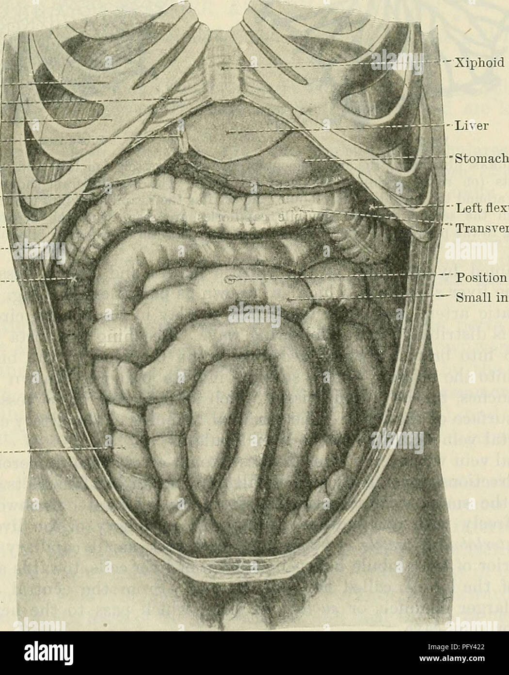 . Cunningham's Text-book of anatomy. Anatomy. VESSELS OF THE LIVER. 1199 number of thorns growing out on all sides from the sublobular twigs of the tree). On each of these little central veins there is impaled, as it were, a lobule. These little conical lobules, with their central veins running through them, are so numerous and so closely packed together, that they give rise to the practically solid liver tissue. The lobules are surrounded by the vense interlobulares, branches of the portal vein, from which numerous twigs enter the lobule on all sides, and converging, join the central vein (Fi Stock Photo