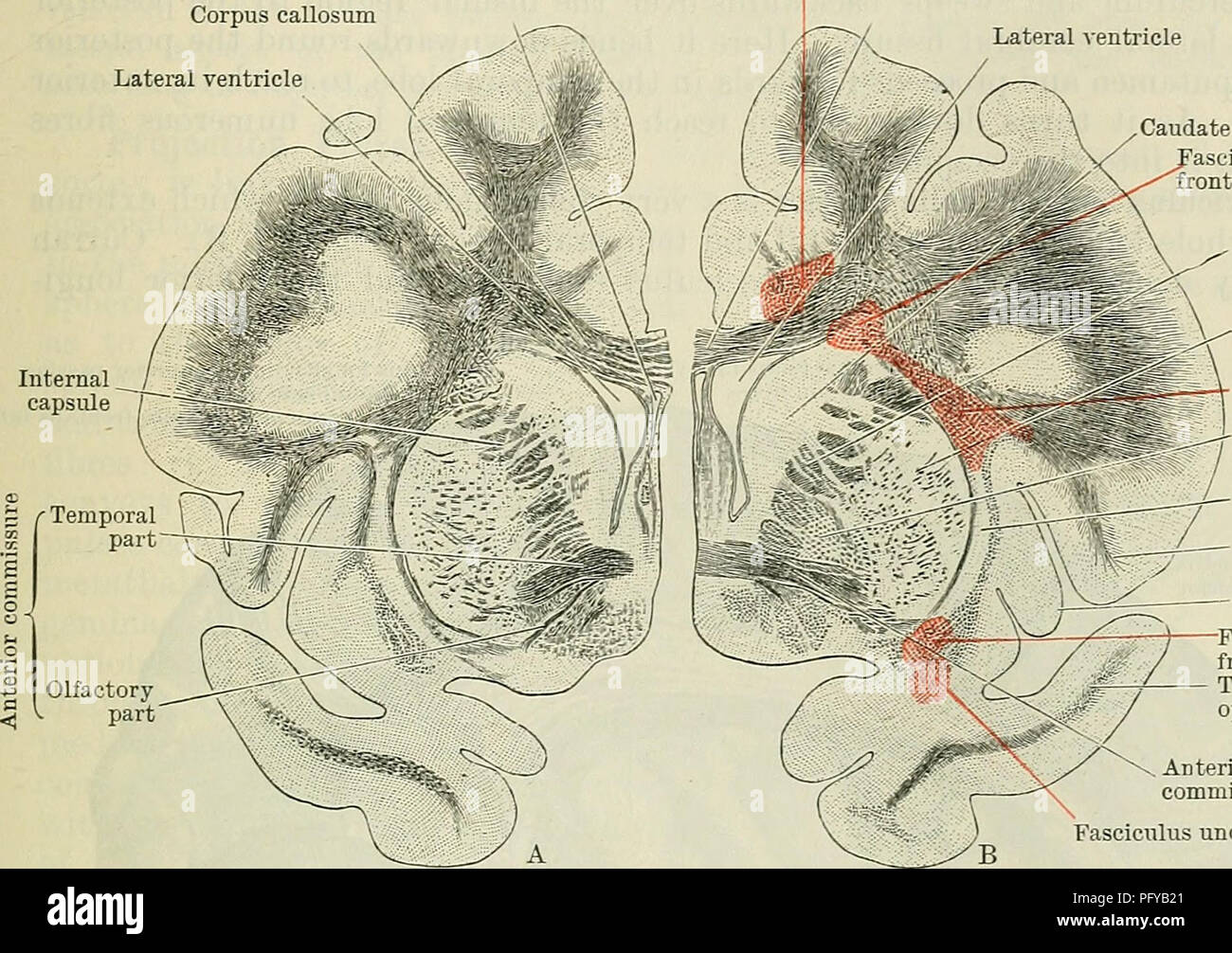 Cunningham S Text Book Of Anatomy Anatomy The White Mattee Of The Ceeebeal Hemispheees 649 Districts Of Gray Cortex Which May Be Far Removed From Each Other The Better Known Of These Fasciculi