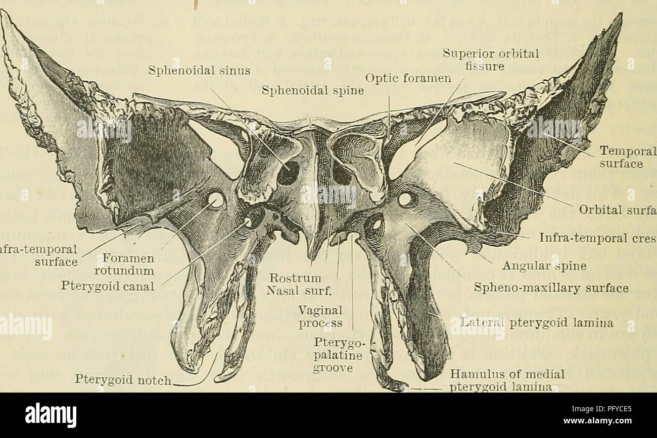 . Cunningham's Text-book of anatomy. Anatomy. Foramen rotund um Groove for auditory tube Petrosal process Pterygoid canal Lateral lamina of the pterygoid process Medial lamina of the pterygoid process Superior orbital fissure Spina angularis Lingula sphenoidalis Scaphoid fossa Pterygoid fossa Fig. 144. Pterygoid notch Hamulus of medial pterygoid lamina -The Sphenoid seen from behind. is usually deflected to one or other side of the median plane. Each sinus extends laterally for a short distance into the root of the great wing, and downwards and laterally towards the base of the pterygoid proc Stock Photo