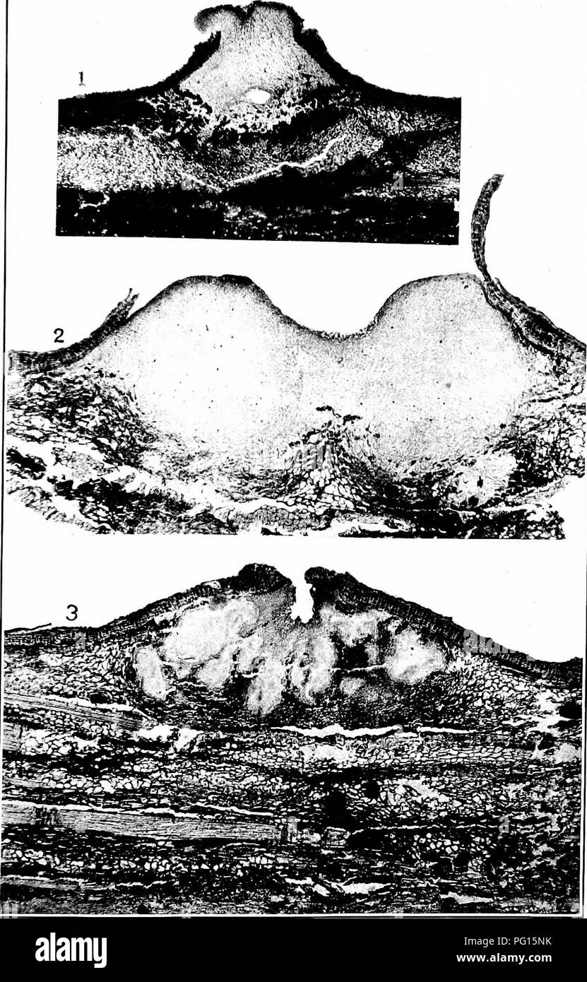. Chestnut blight. Chestnut blight; Chestnut. Bui. 380, U. S. Depf. of Agriculturi Plate XV.. ENDOTHIA PARASITICA. VERTICAL SECTIONS OF STROMATA. X 49. Fig. 1 .—Showing a Young, Simple Pycnidial Cavity at the Base. Fig. 2.—In Which Neither Pycnidia Nor Perithecia Have Begun to Develop. Fig. 3.—With Irregular Chambered Pycnidia. All the above aie about the same age—four moulh.s after iuoculatiou.. Please note that these images are extracted from scanned page images that may have been digitally enhanced for readability - coloration and appearance of these illustrations may not perfectly resemble Stock Photo