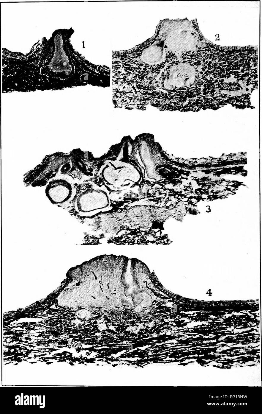. Chestnut blight. Chestnut blight; Chestnut. Bui. 380, U. S. Dept of Agriculture. Plate XIV.. ENDOTHIA FLUENS. VERTICAL SECTIONS. X 49. Fig. 1 .—Simple Pycnidium with Very Little Stroma, from Italy. Fig. 2.—Stroma FROM Italy, Showing a Perithecium above a Pycnidium. Fig. 3.—Stroma from America, Showing a Mature Pycnidium and Perithecia Side by Side. Fig. 4.— Stroma, Showing a Single Pycnidium and Fundaments of Perithecia below.. Please note that these images are extracted from scanned page images that may have been digitally enhanced for readability - coloration and appearance of these illust Stock Photo