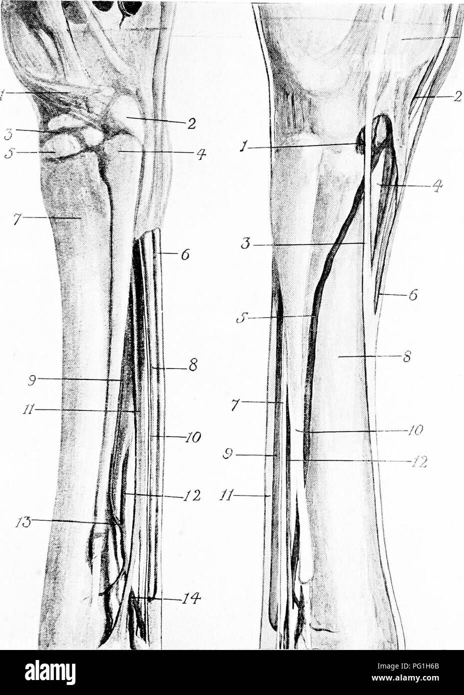 . The surgical anatomy of the horse ... Horses. Plate XXVIII.—Metatarsal Region, showing Arteries, Tendons, Ligaments, Bones, etc. A.—INNER aspect I. Cunean tendon. 2. Cuneiform parvum. 3. Scaphoid. 4. Head of inner small metatarsal bone. 5. Cuneiform magnum. 6. Perforatus tendon. 7. Large metatarsal bone. 8. Perforans tendon. 9. Internal plantar interosseous artery. 10. Internal plantar nerve. 11. Suspensory ligament. 12. Large metatarsal artery. 13. Anastomosis of large metatarsal and internal plantar interosseous arteries. 14. Division of large metatarsal into the two digital arteries. B.—O Stock Photo