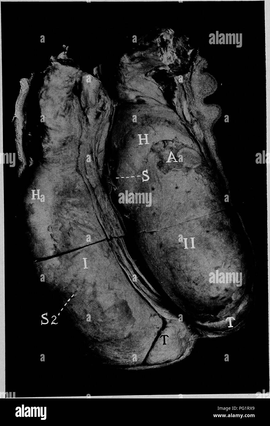 Orchitis High Resolution Stock Photography And Images Alamy